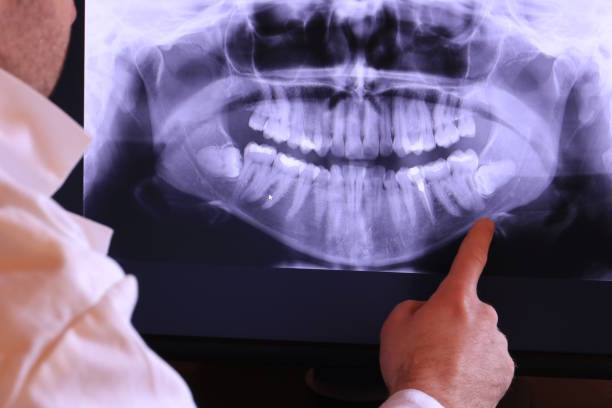 Tooth Infection Emergency Dentist in WI